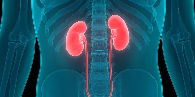 bobrek-kanseri-