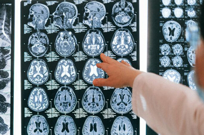 kanserde-erken-teshis Kanserde erken teşhiste yüzde 90 olumlu sonuç alınabiliyor