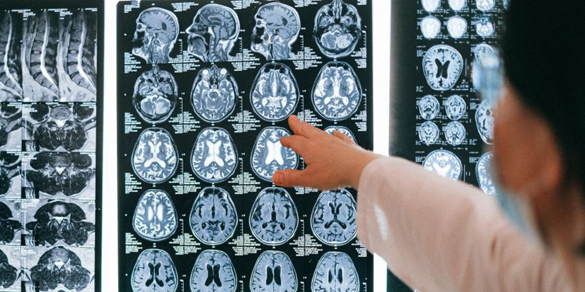 Kanserde erken teşhiste yüzde 90 olumlu sonuç alınabiliyor